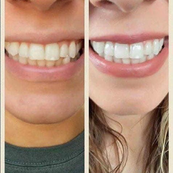 THE BEST Whitening Toothpaste!  NO HARSH CHEMICALS - Picture 4 of 12